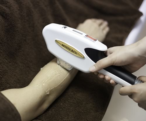 Step4 無料テスト脱毛