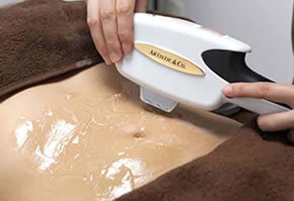 BODY ボディ脱毛