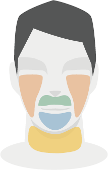 全顔ヒゲ脱毛イラスト