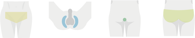 デリケートゾーン4部位イラスト