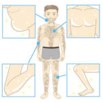 メンズ全身脱毛のメリット、デメリット!